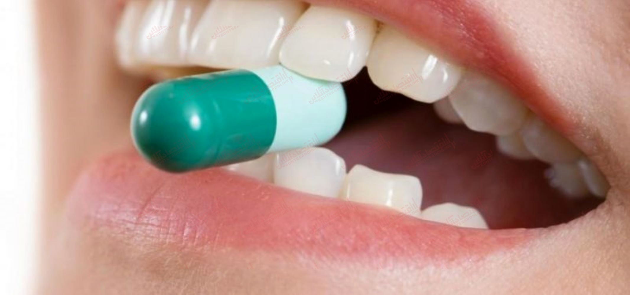 Антибиотики при флюсе десны. Тетрациклиновые зубы отбеливание. Тетрациклиновая эмаль. Системная гипоплазия тетрациклиновые зубы.
