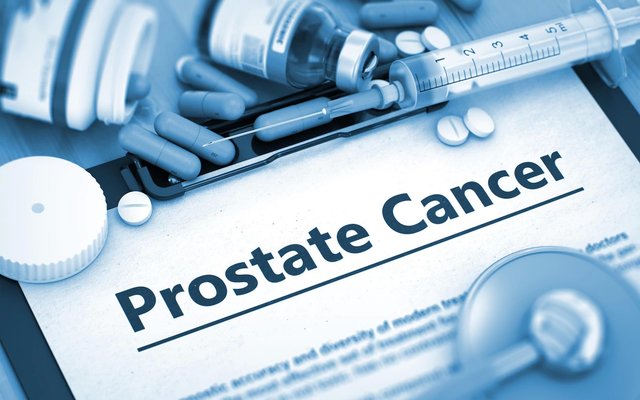 سرطان پروستات به راحتی با این روش ساده قابل پیش بینی است!