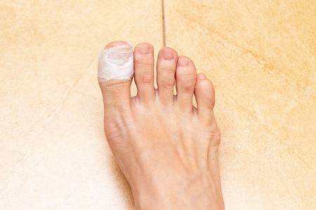 نشانه های بروز عفونت ناخن پا چیست؟