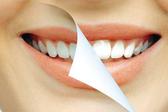 نقش مواد معدنی در بهداشت دهان و دندان