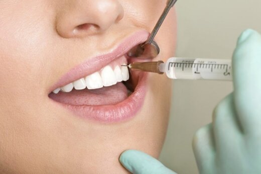 باورهای غلط در مورد بهداشت دهان و دندان