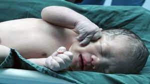تولد شگفت انگیز یک نوزاد در هند با سه دست! + فیلم