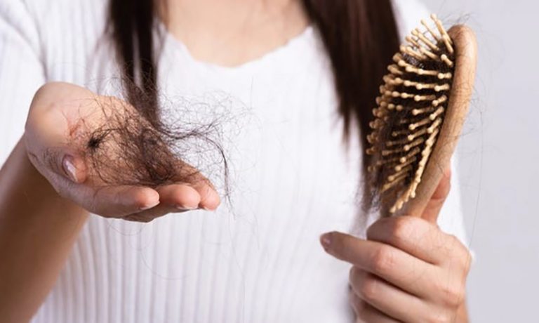 چرا پس از کرونا دچار ریزش مو می شویم؟