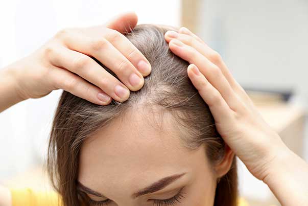 چند راه عالی برای درمان ریزش موی شقیقه ها