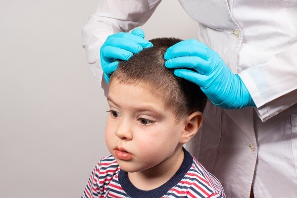 چگونه از شپش سر در کودکان جلوگیری کنیم