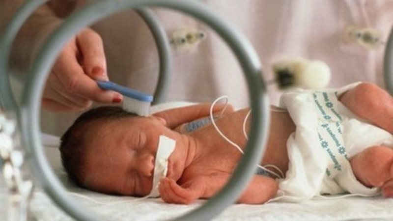 درمان های ناباروری تاثیر کمی در تولد نوزادان نارس دارند