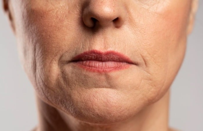 عوارض جدی استفاده از لیف برای پوست صورت